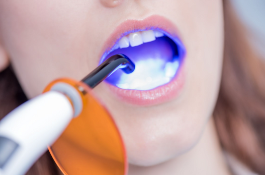 LED Fotopolimerizador Odontológico: Como Funciona e Quais os Benefícios na Prática Clínica