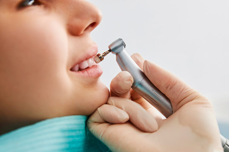 Contra Ângulo Odontológico para Implante e Limpeza: precisão, controle e segurança clínica